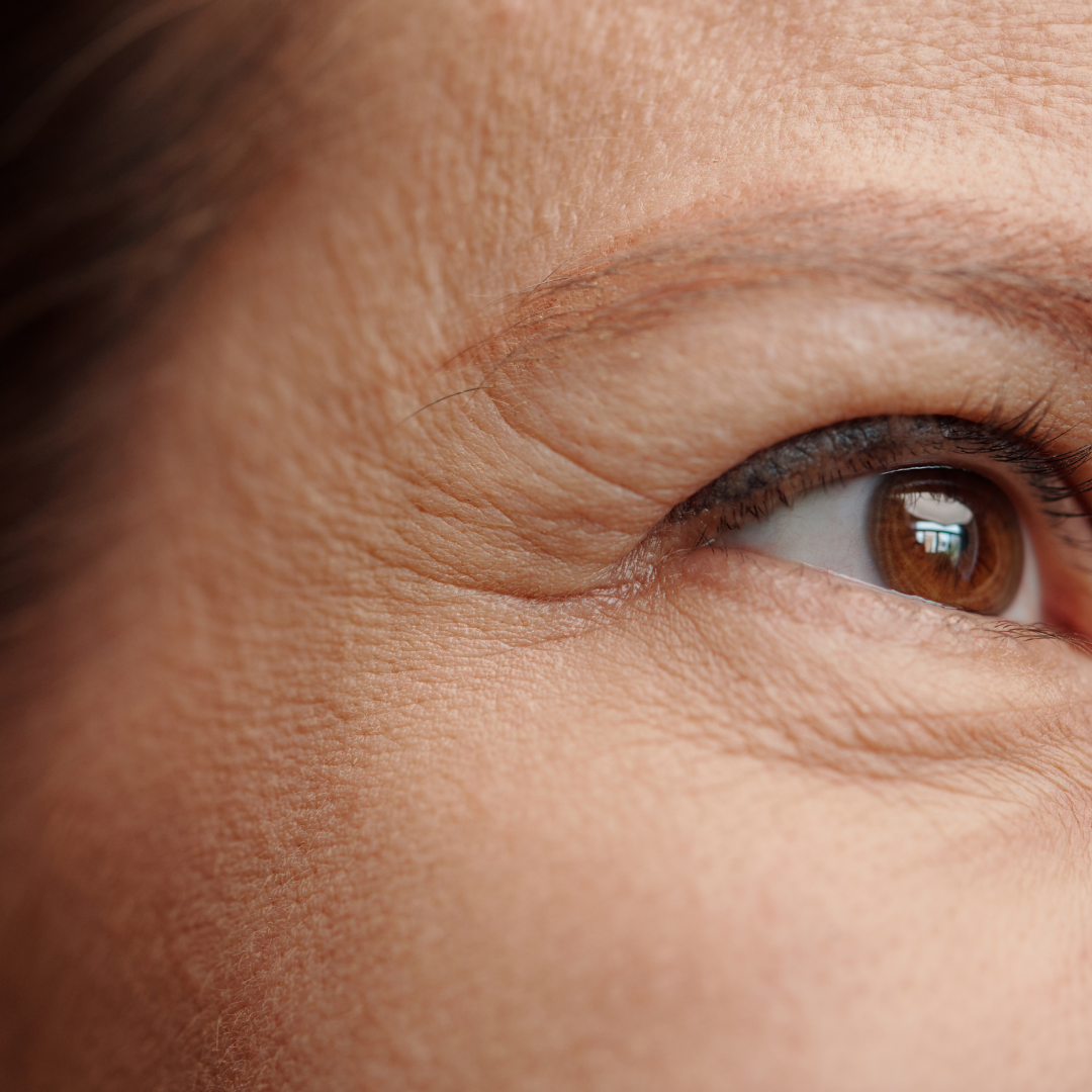 Anti Aging Wrinkle Reduction